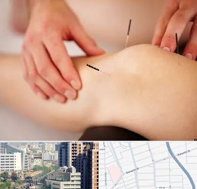 دکتر طب سوزنی برای لاغری در خیابان بهشتی