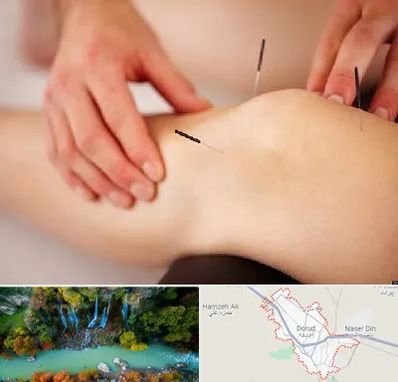 دکتر طب سوزنی برای لاغری در دورود
