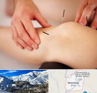 دکتر طب سوزنی برای لاغری در شمشک