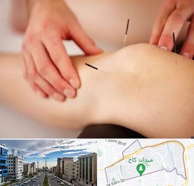 دکتر طب سوزنی برای لاغری در سعادت آباد 