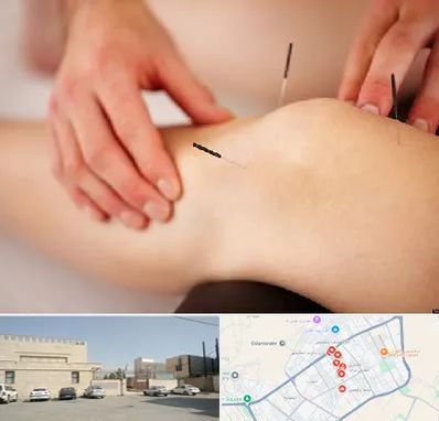 دکتر طب سوزنی برای لاغری در نواب اسلامشهر 