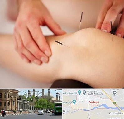 دکتر طب سوزنی برای لاغری در پاکدشت