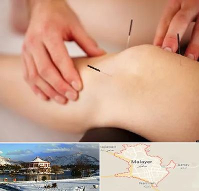 دکتر طب سوزنی برای لاغری در ملایر
