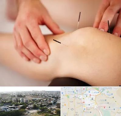 دکتر طب سوزنی برای لاغری در منطقه 20 تهران