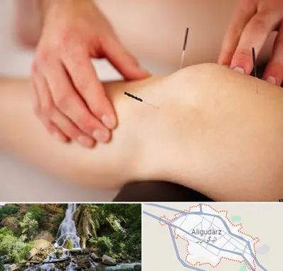 دکتر طب سوزنی برای لاغری در الیگودرز