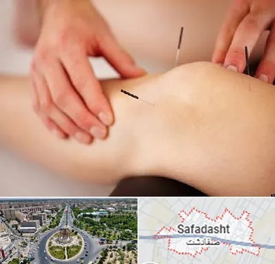 دکتر طب سوزنی برای لاغری در صفادشت