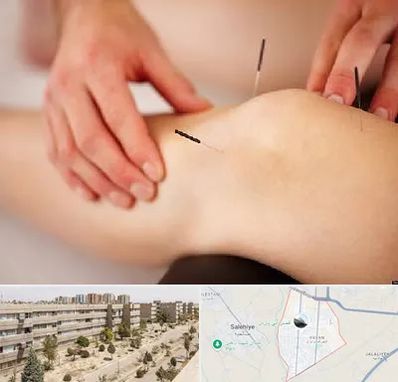 دکتر طب سوزنی برای لاغری در واوان اسلامشهر 