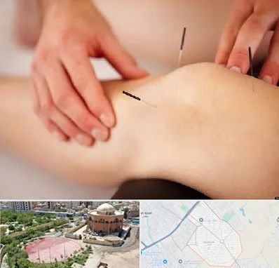 دکتر طب سوزنی برای لاغری در گلستان اسلامشهر 