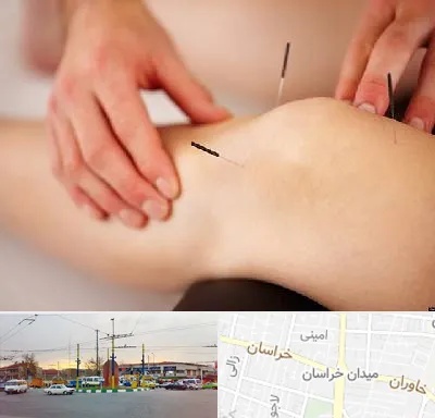 دکتر طب سوزنی برای لاغری در میدان خراسان