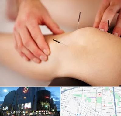 دکتر طب سوزنی برای لاغری در بلوار اباذر