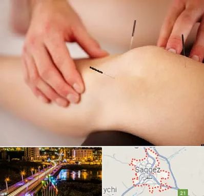 دکتر طب سوزنی برای لاغری در سقز