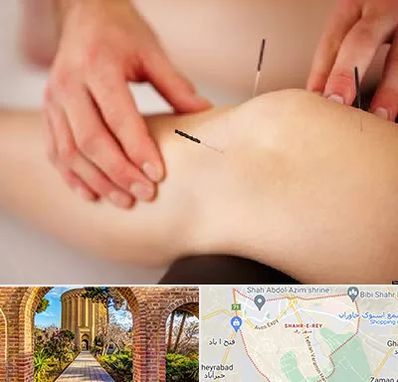 دکتر طب سوزنی برای لاغری در شهر ری