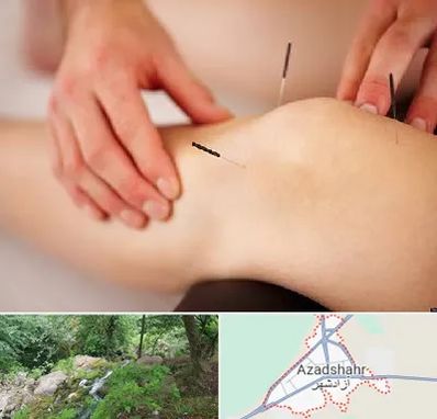 دکتر طب سوزنی برای لاغری در آزادشهر
