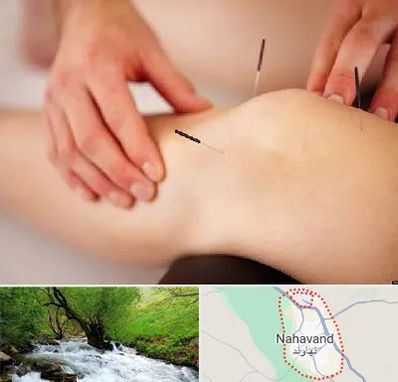 دکتر طب سوزنی برای لاغری در نهاوند