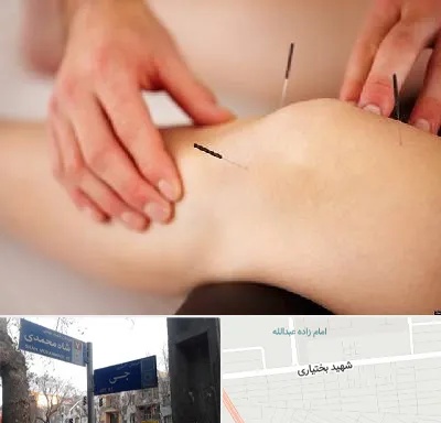 دکتر طب سوزنی برای لاغری در سی متری جی