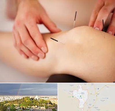 دکتر طب سوزنی برای لاغری در تربت حیدریه