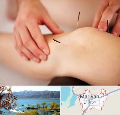 دکتر طب سوزنی برای لاغری در مریوان