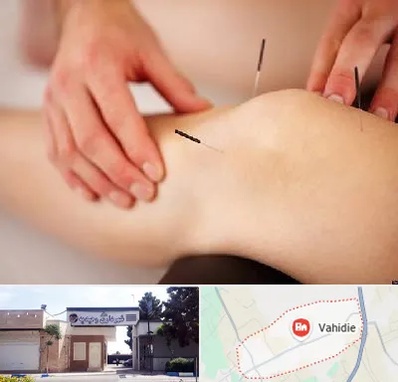 دکتر طب سوزنی برای لاغری در وحیدیه شهریار