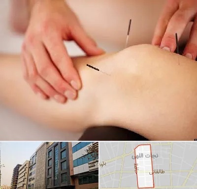 دکتر طب سوزنی برای لاغری در نجات اللهی