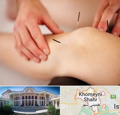 دکتر طب سوزنی برای لاغری در خمینی شهر