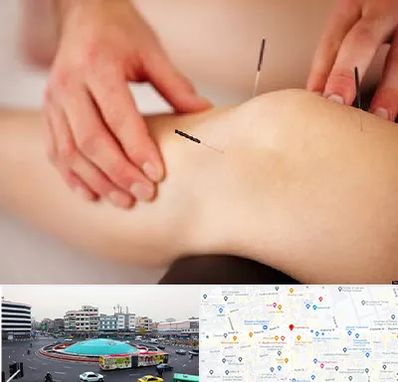 دکتر طب سوزنی برای لاغری در میدان انقلاب 