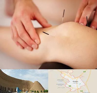 دکتر طب سوزنی برای لاغری در سیرجان