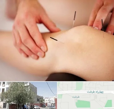 دکتر طب سوزنی برای لاغری در طرشت