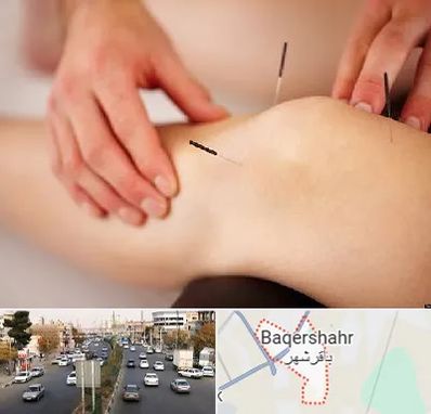 دکتر طب سوزنی برای لاغری در باقرشهر