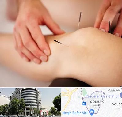 دکتر طب سوزنی برای لاغری در قلهک 