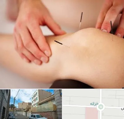 دکتر طب سوزنی برای لاغری در خزانه