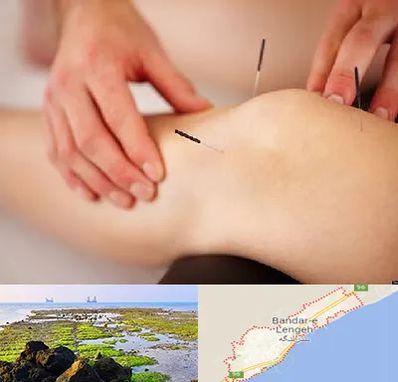 دکتر طب سوزنی برای لاغری در بندرلنگه