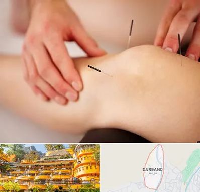 دکتر طب سوزنی برای لاغری در دربند