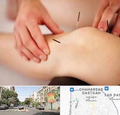 دکتر طب سوزنی برای لاغری در چهارصد دستگاه 