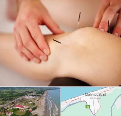 دکتر طب سوزنی برای لاغری در محمودآباد