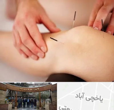 دکتر طب سوزنی برای لاغری در یاخچی آباد