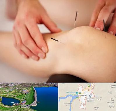 دکتر طب سوزنی برای لاغری در مهاباد