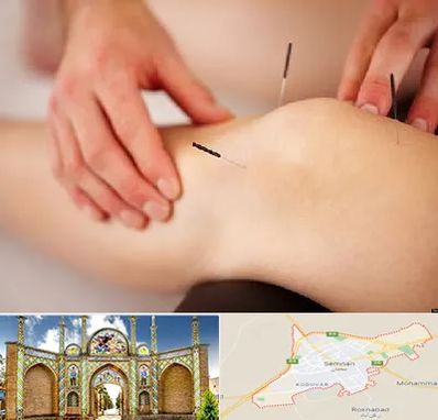 دکتر طب سوزنی برای لاغری در سمنان