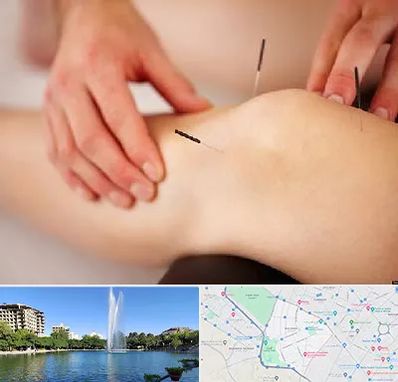 دکتر طب سوزنی برای لاغری در کوهسنگی مشهد
