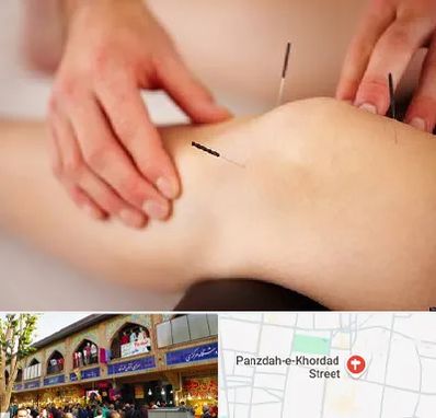 دکتر طب سوزنی برای لاغری در 15 خرداد