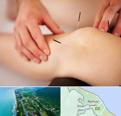 دکتر طب سوزنی برای لاغری در رامسر