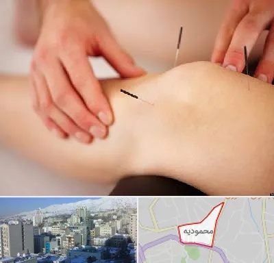 دکتر طب سوزنی برای لاغری در محمودیه