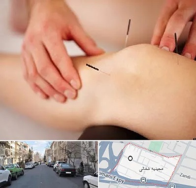 دکتر طب سوزنی برای لاغری در مجیدیه شمالی