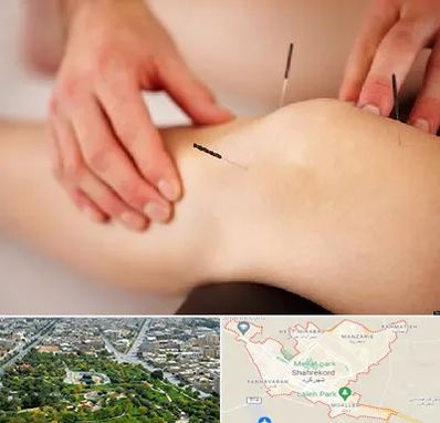دکتر طب سوزنی برای لاغری در شهرکرد