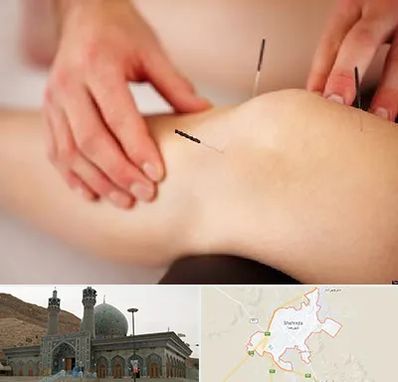 دکتر طب سوزنی برای لاغری در شهرضا