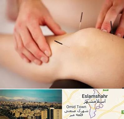 دکتر طب سوزنی برای لاغری در اسلامشهر