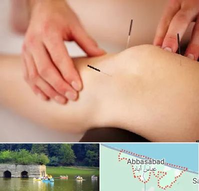 دکتر طب سوزنی برای لاغری در عباس آباد