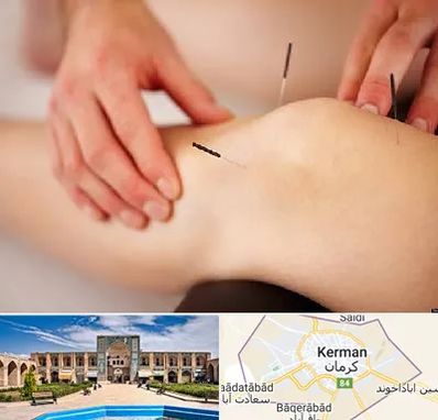 دکتر طب سوزنی برای لاغری در کرمان