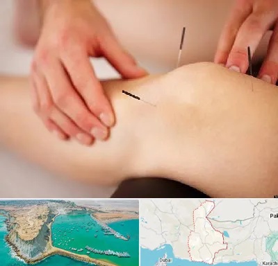 دکتر طب سوزنی برای لاغری در سیستان و بلوچستان