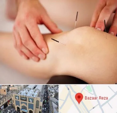 دکتر طب سوزنی برای لاغری در بازار رضا مشهد