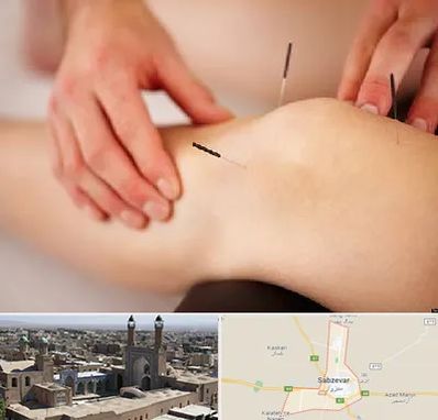 دکتر طب سوزنی برای لاغری در سبزوار